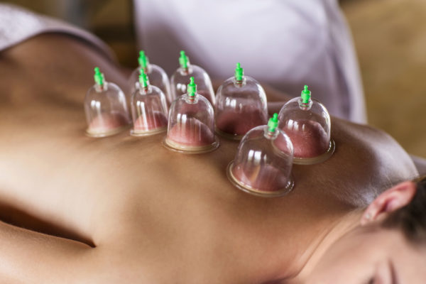 Diploma in Cupping Massage Therapy