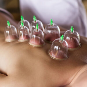 Diploma in Cupping Massage Therapy