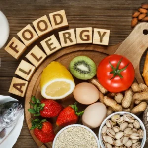 Food Allergen Awareness Training